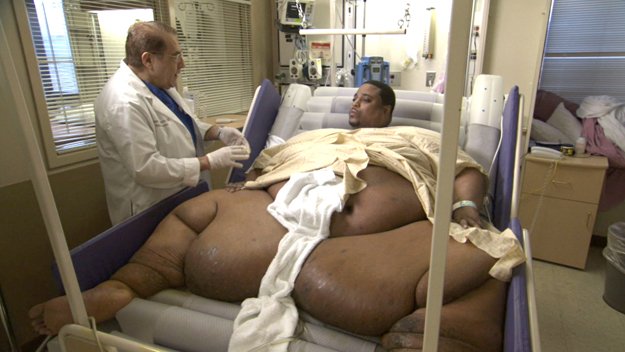  Fattest Man Alive