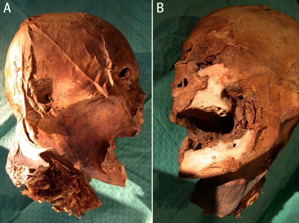 Mummified-head-of-henry-iv